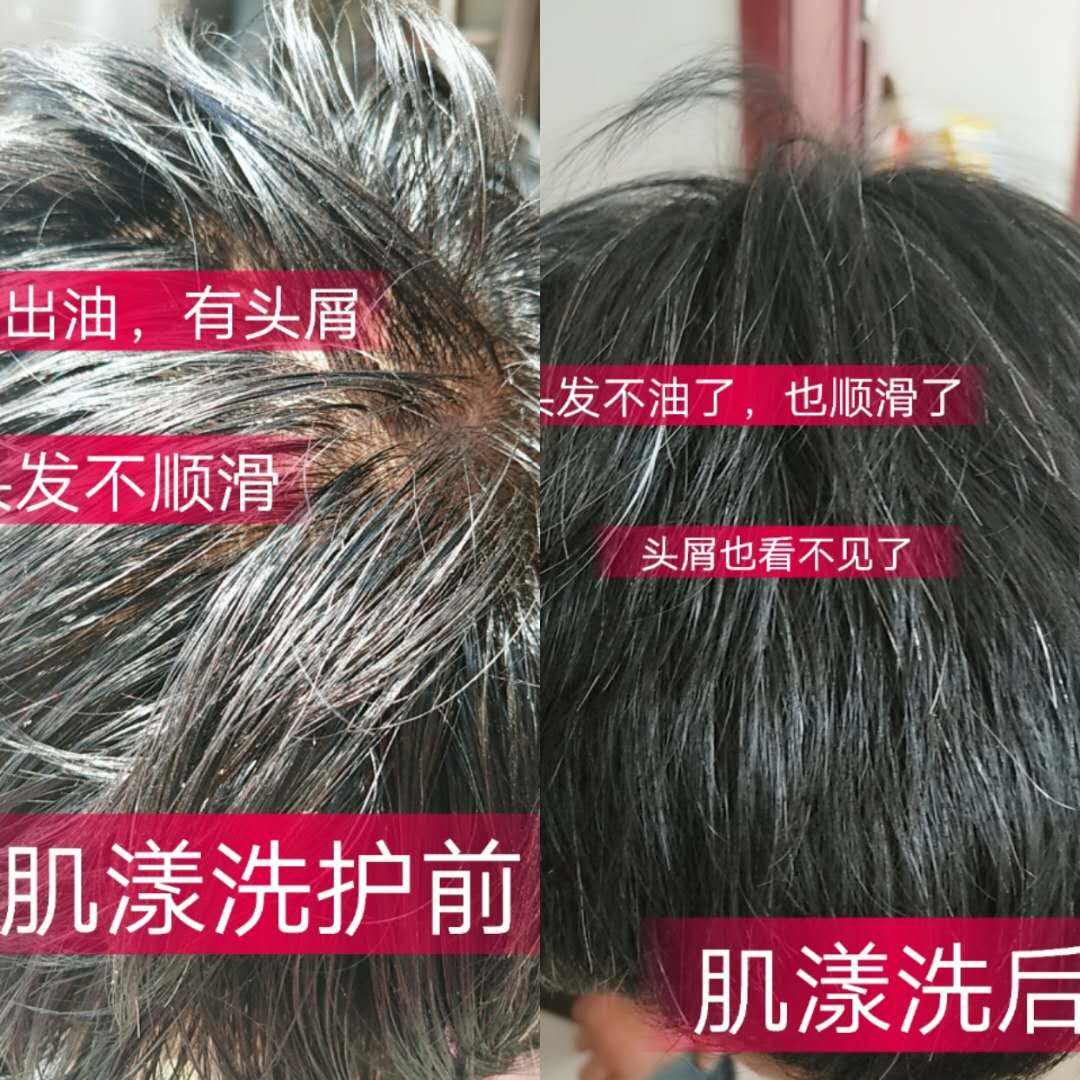 一叶子肌漾洗发水好用吗，头发问题可以解决吗？(www.zzx8.com)